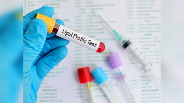 Regular blood tests can help monitor heart health